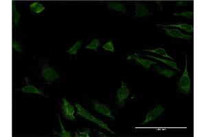 Immunofluorescence of monoclonal antibody to CD40 on HeLa cell. (CD40 抗体  (AA 21-193))