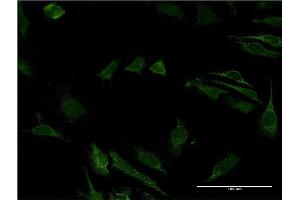 Immunofluorescence of monoclonal antibody to CD40 on HeLa cell. (CD40 抗体  (AA 21-193))