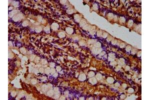 IHC image of ABIN7173930 diluted at 1:300 and staining in paraffin-embedded human small intestine tissue performed on a Leica BondTM system. (TUSC3 抗体  (AA 42-196))