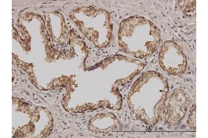 Immunoperoxidase of monoclonal antibody to PSMD5 on formalin-fixed paraffin-embedded human prostate. (PSMD5 抗体  (AA 405-504))
