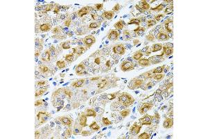 Immunohistochemistry of paraffin-embedded human stomach using MTTP antibody (ABIN5970876) at dilution of 1/100 (40x lens).