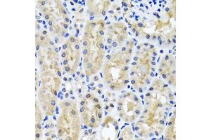 Immunohistochemistry of paraffin-embedded mouse kidney using SNAP29 antibody. (SNAP29 抗体)