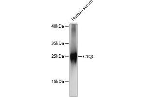 Western Blotting (WB) image for anti-Complement Component 1, Q Subcomponent, C Chain (C1QC) (AA 50-150) antibody (ABIN7266475)