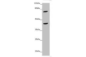 Western blot All lanes: ACSL6 antibody at 4. (ACSL6 抗体  (AA 458-697))