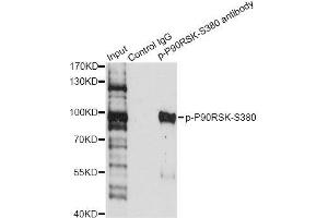 Immunoprecipitation analysis of 200 μg extracts of HeLa cells treated by EGF using 2. (RPS6KA3 抗体  (pSer380))