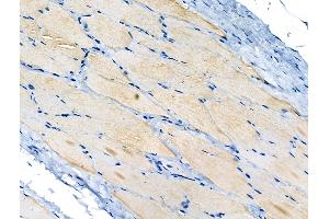 ABIN6264983 and ABIN6266656 at 1/100 staining Rat skin tissue by IHC-P. (SENP1 抗体  (N-Term))