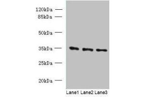 Western blot All lanes: C15orf41 antibody at 1. (BC052040 抗体  (AA 1-183))