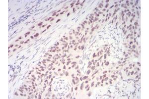 Immunohistochemistry (IHC) image for anti-Chromobox Homolog 1 (CBX1) (AA 1-185) antibody (ABIN5542477)