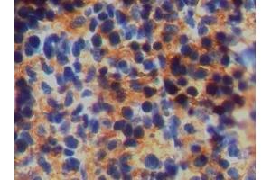 Immunohistochemistry (IHC) image for anti-Ferritin, Heavy Polypeptide 1 (FTH1) antibody (ABIN7437164)
