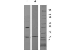 SDS-PAGE of Rat Interferon gamma Recombinant Protein SDS-PAGE Rat Interferon gamma Recombinant Protein. (IFNG1-2 蛋白)
