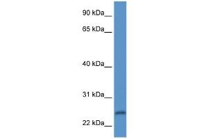 WB Suggested Anti-PI15 Antibody Titration: 1. (PI15 抗体  (N-Term))