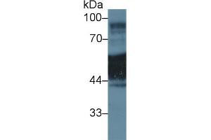 Western blot analysis of Human A431 cell lysate, using Rat KRT1 Antibody (1 µg/ml) and HRP-conjugated Goat Anti-Rabbit antibody ( (Cytokeratin 1 抗体  (AA 350-488))