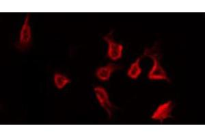 ABIN6266449 staining Hela by IF/ICC. (CCR5 抗体  (pSer349))