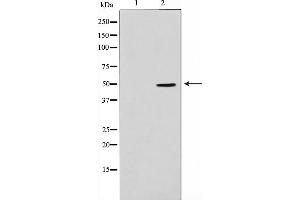 Western blot analysis on Jurkat cell lysate using ADPGK Antibody,The lane on the left is treated with the antigen-specific peptide. (ADPGK 抗体  (Internal Region))