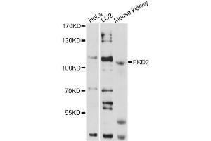 Western blot analysis of extracts of various cell lines, using PKD2 antibody (ABIN1874147) at 1:1000 dilution. (PKD2 抗体)