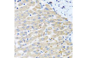 Immunohistochemistry of paraffin-embedded human liver injury using DARS2 antibody at dilution of 1:100 (x40 lens). (DARS2 抗体)