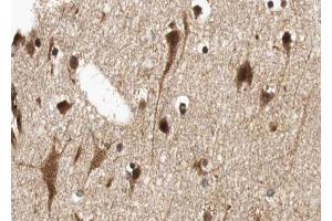 ABIN6268752 at 1/100 staining human brain tissue sections by IHC-P. (MYCN 抗体  (Internal Region))