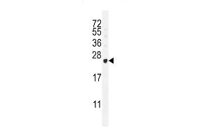 GAGE12B Antibody (N-term) (ABIN655201 and ABIN2844816) western blot analysis in T47D cell line lysates (35 μg/lane). (G Antigen 12B 抗体  (N-Term))