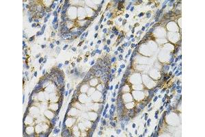 Immunohistochemistry of paraffin-embedded Human colon using DEFB132 Polyclonal Antibody at dilution of 1:100 (40x lens). (DEFB132 抗体)