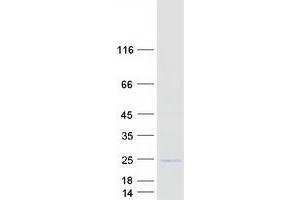 Western Blotting (WB) image for Signal Peptidase Complex Subunit 3 Homolog (SPCS3) protein (Myc-DYKDDDDK Tag) (ABIN2732543)
