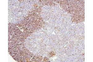 IHC analysis of CD8A using anti-CD8A antibody (ABIN6719524). (CD8 alpha 抗体  (AA 27-114))