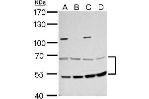 WB Image MCD antibody detects MCD protein by western blot analysis. (MLYCD 抗体)