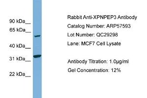 WB Suggested Anti-XPNPEP3  Antibody Titration: 0. (XPNPEP3 抗体  (N-Term))