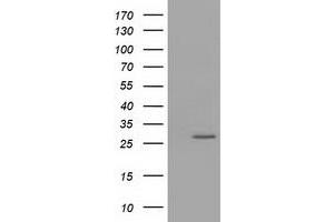 Western Blotting (WB) image for anti-OTU Domain, Ubiquitin Aldehyde Binding 2 (OTUB2) antibody (ABIN1499939) (OTUB2 抗体)