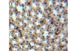 IHC-P analysis of Kidney tissue, with DAB staining. (HTRA1 抗体  (AA 204-364))