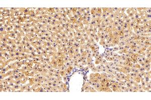 Detection of C3 Convertase in Mouse Liver Tissue using Polyclonal Antibody to Complement C3 Convertase (C3 Convertase) (Complement C3 Convertase 抗体)