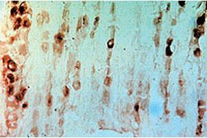Immunohistochemical staining of rat dorsal root ganglia using rabbit Gfra3 polyclonal antibody  . (GFRA3 抗体  (AA 1-11))
