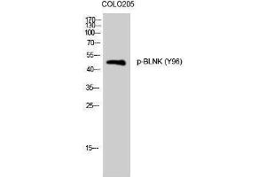 Western Blotting (WB) image for anti-B-Cell Linker (BLNK) (pTyr96) antibody (ABIN3182572) (B-Cell Linker 抗体  (pTyr96))