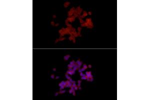 Immunofluorescence analysis of SH-SY5Y cells using PGP9. (UCHL1 抗体  (AA 1-220))
