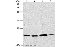 Western blot analysis of 293T, hela and PC3 cell, human liver cancer tissue, using PRDX2 Polyclonal Antibody at dilution of 1:750 (Peroxiredoxin 2 抗体)
