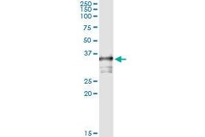 Immunoprecipitation of TOMM34 transfected lysate using anti-TOMM34 monoclonal antibody and Protein A Magnetic Bead , and immunoblotted with TOMM34 MaxPab rabbit polyclonal antibody. (TOMM34 抗体  (AA 1-309))