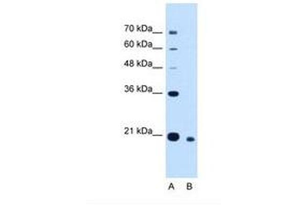 CDCA4 Antikörper  (N-Term)
