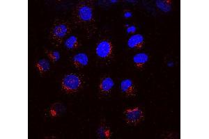 Immunocytochemistry/Immunofluorescence analysis using Mouse Anti-KDEL Receptor Monoclonal Antibody, Clone KR-10 . (KDELR 抗体  (AA 192-212) (Biotin))
