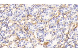 Detection of ALB in Rat Kidney Tissue using Polyclonal Antibody to Albumin (ALB) (Albumin 抗体)