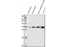 Western blot analysis of VAPB using anti-VAPB antibody (ABIN5693292). (VAPB 抗体  (AA 2-55))