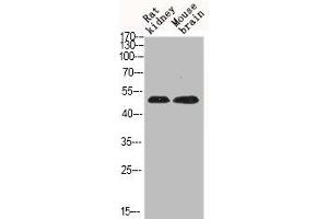 Western Blot analysis of RAT-KIDNEY mouse-brain cells using Phospho-JNK1/2/3 (T183) Polyclonal Antibody (MAPK8/MAPK9/MAPK1 (pThr183) 抗体)