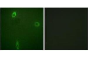 Immunofluorescence (IF) image for anti-Potassium Inwardly-Rectifying Channel, Subfamily J, Member 1 (KCNJ1) (AA 11-60), (pSer44) antibody (ABIN1531698)