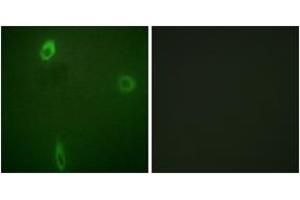 Immunofluorescence analysis of A549 cells, using ROMK/Kir1. (KCNJ1 抗体  (pSer44))