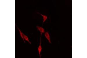 Immunofluorescence (fixed cells) (IF/ICC) image for anti-TNFRSF1A-Associated Via Death Domain (TRADD) (N-Term) antibody (ABIN6265701)