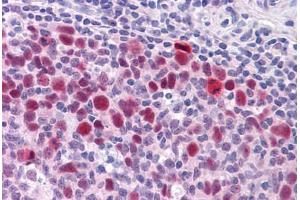 Immunohistochemistry (Formalin-fixed Paraffin-embedded Sections) (IHC (fp)) image for anti-SRY (Sex Determining Region Y)-Box 9 (SOX9) (AA 400-510) antibody (ABIN574345)
