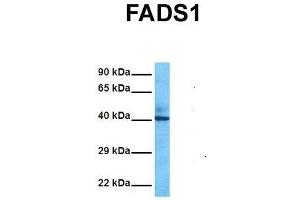 Host:  Rabbit  Target Name:  FADS1  Sample Tissue:  Human Fetal Liver  Antibody Dilution:  1. (FADS1 抗体  (C-Term))