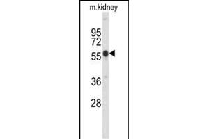 Western blot analysis of Park6 (PINK1) C-term (ABIN652208 and ABIN2840776) in mouse kidney tissue lysates (35 μg/lane). (PINK1 抗体  (C-Term))