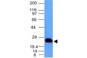 Western Blot Analysis of human Brain lysate using Pgp9.