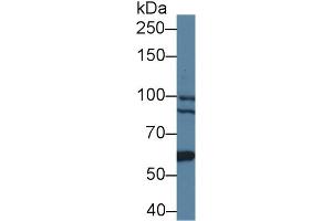 Western blot analysis of Human 293T cell lysate, using Mouse BCOR Antibody (1 µg/ml) and HRP-conjugated Goat Anti-Rabbit antibody ( (BCOR 抗体  (AA 1553-1755))