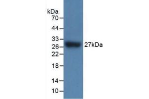 Detection of Recombinant IL17RC, Mouse using Polyclonal Antibody to Interleukin 17 Receptor C (IL17RC) (IL17RC 抗体  (AA 73-330))