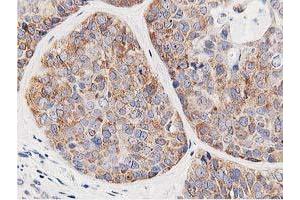 Immunohistochemistry (IHC) image for anti-Leucine Carboxyl Methyltransferase 1 (LCMT1) antibody (ABIN1499107) (LCMT1 抗体)